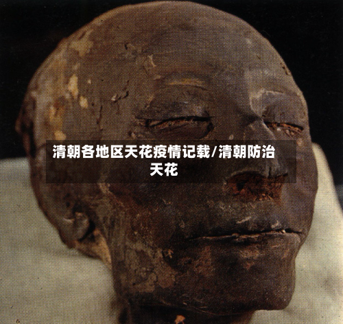 清朝各地区天花疫情记载/清朝防治天花-第3张图片
